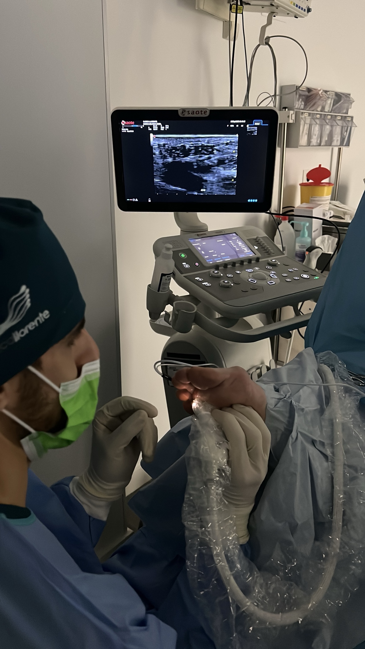 Radiofrecuencia para neuroma de morton