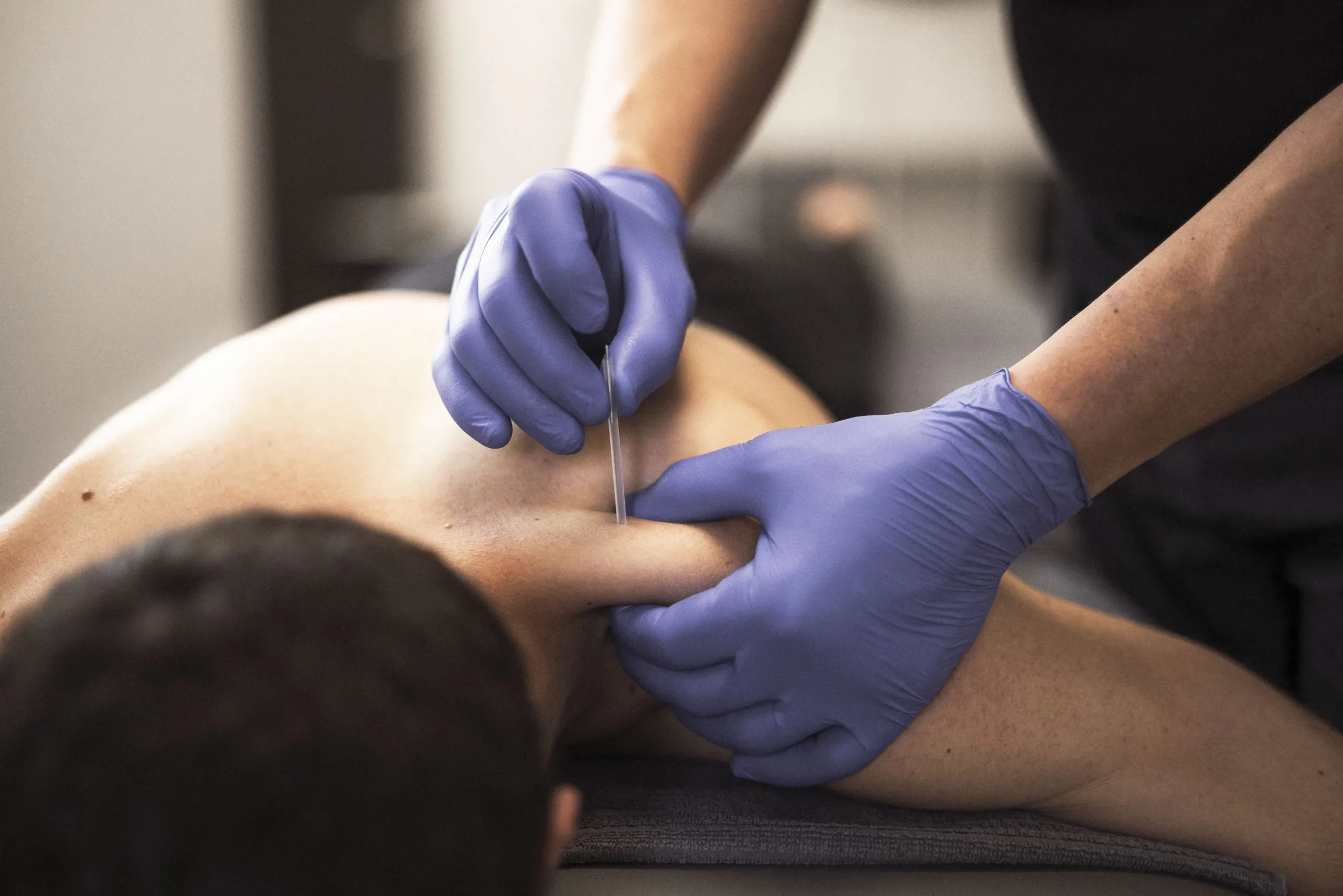 Punción seca en Santander